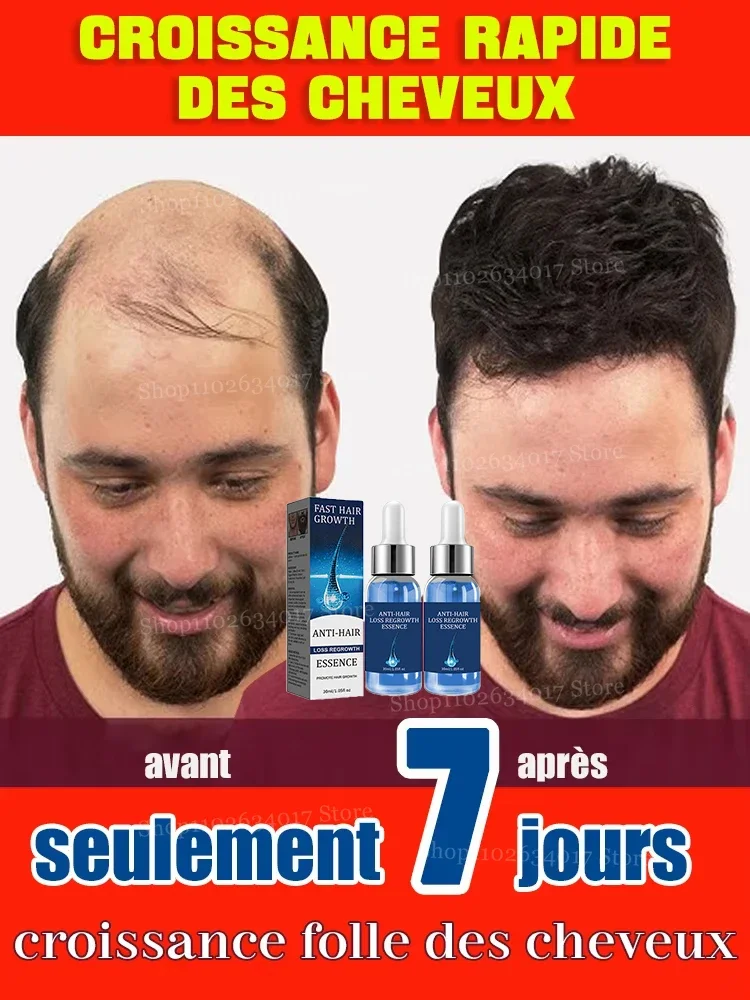 Luksusowa pielęgnacja skóry głowy: Premiumowe serum na porost włosów z peptydami