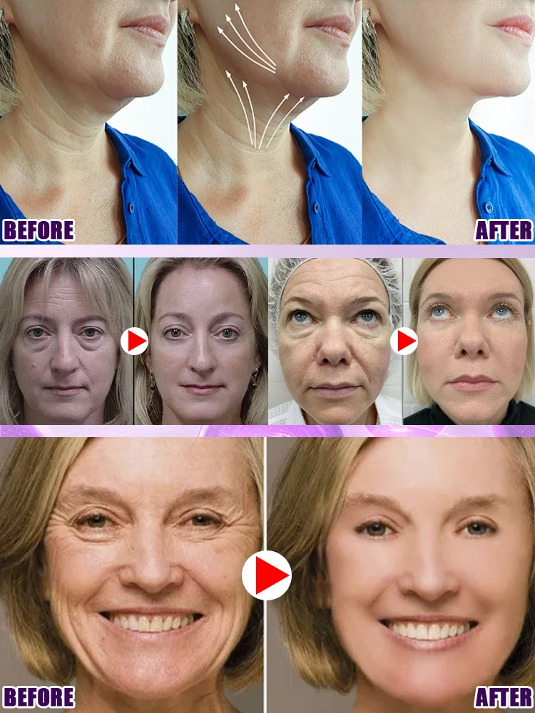 

Anti-wrinkle easily and show your most beautiful self