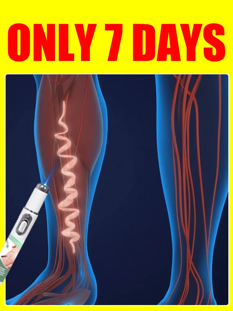 Stylo laser à lumière bleue, conjunto de herramientas universales para le soin des jambes
