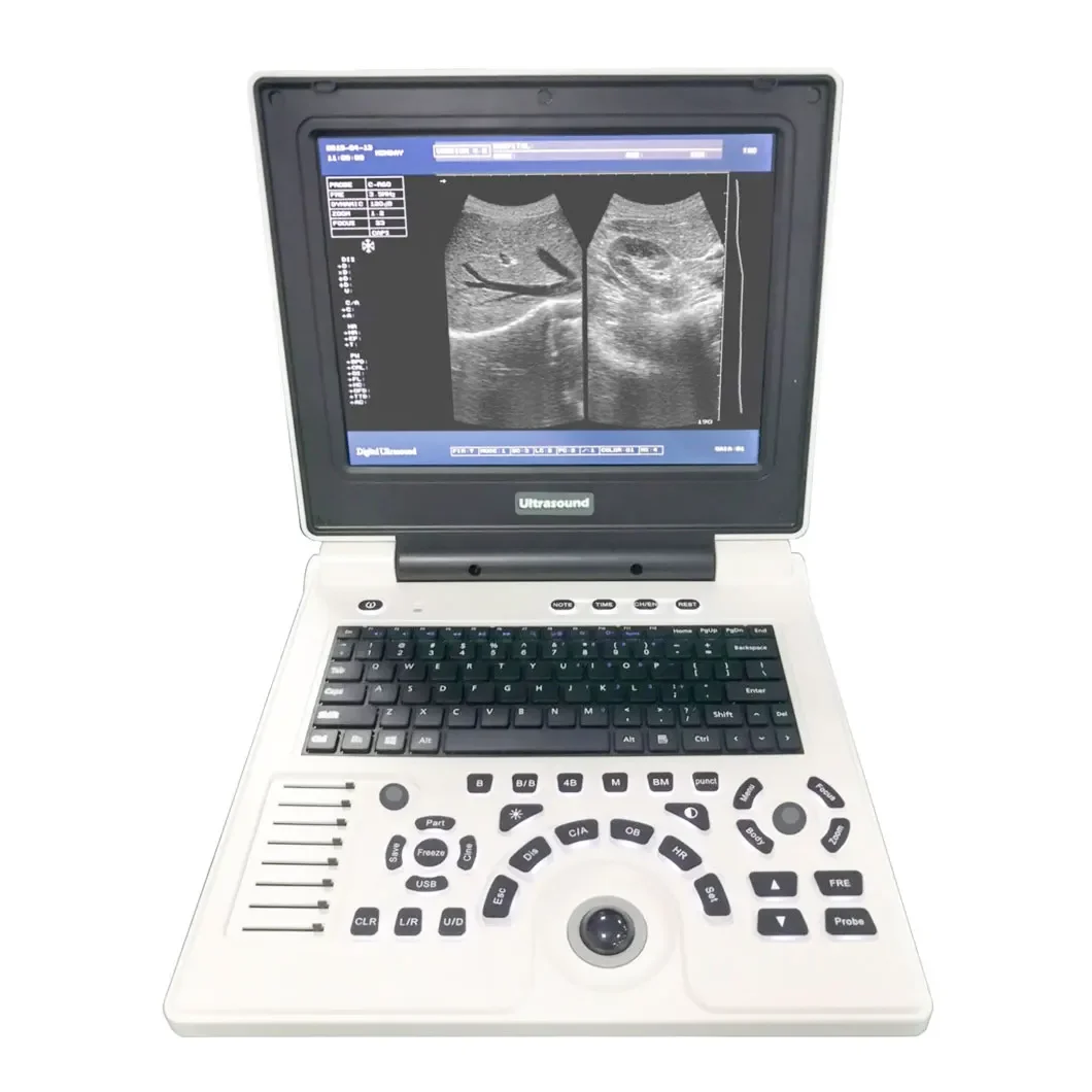 Ultrasonic Diagnostic Instruments Portable Ultrasound Device B W Ultra sound