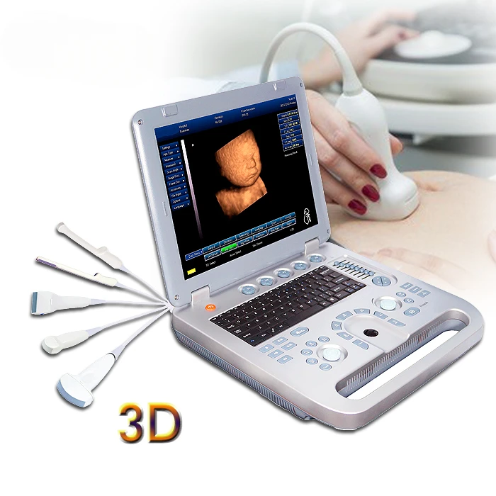 Hot Sale And Best Seller 3D 4D Portable Ultrasound Machine economic/ecografo ultrasonido portatil en 3d 4d