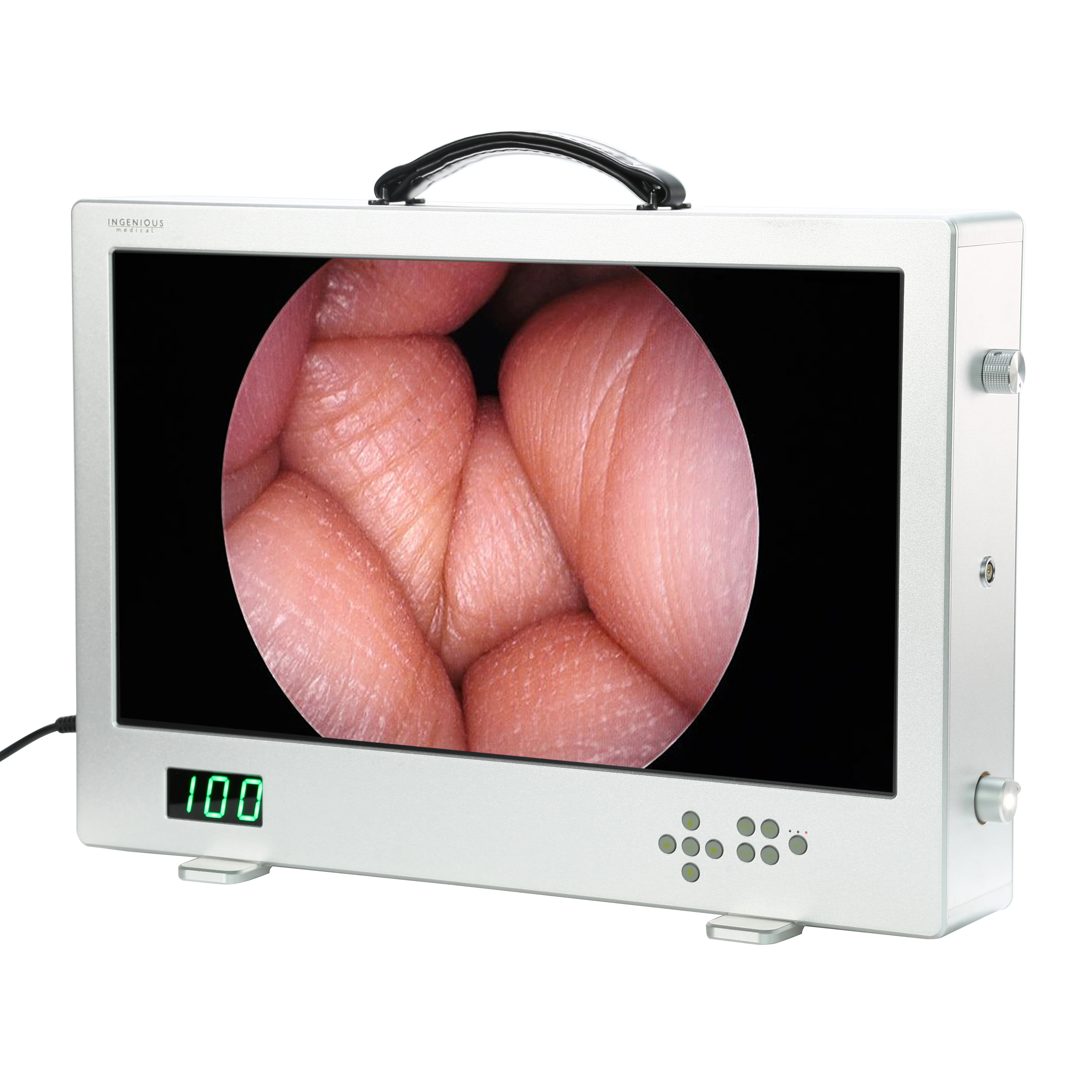 1080P 24 Inches 4 In 1 Integrated Medical Diagnostic Equipment Video System, All In One Portable Hd Endoscope