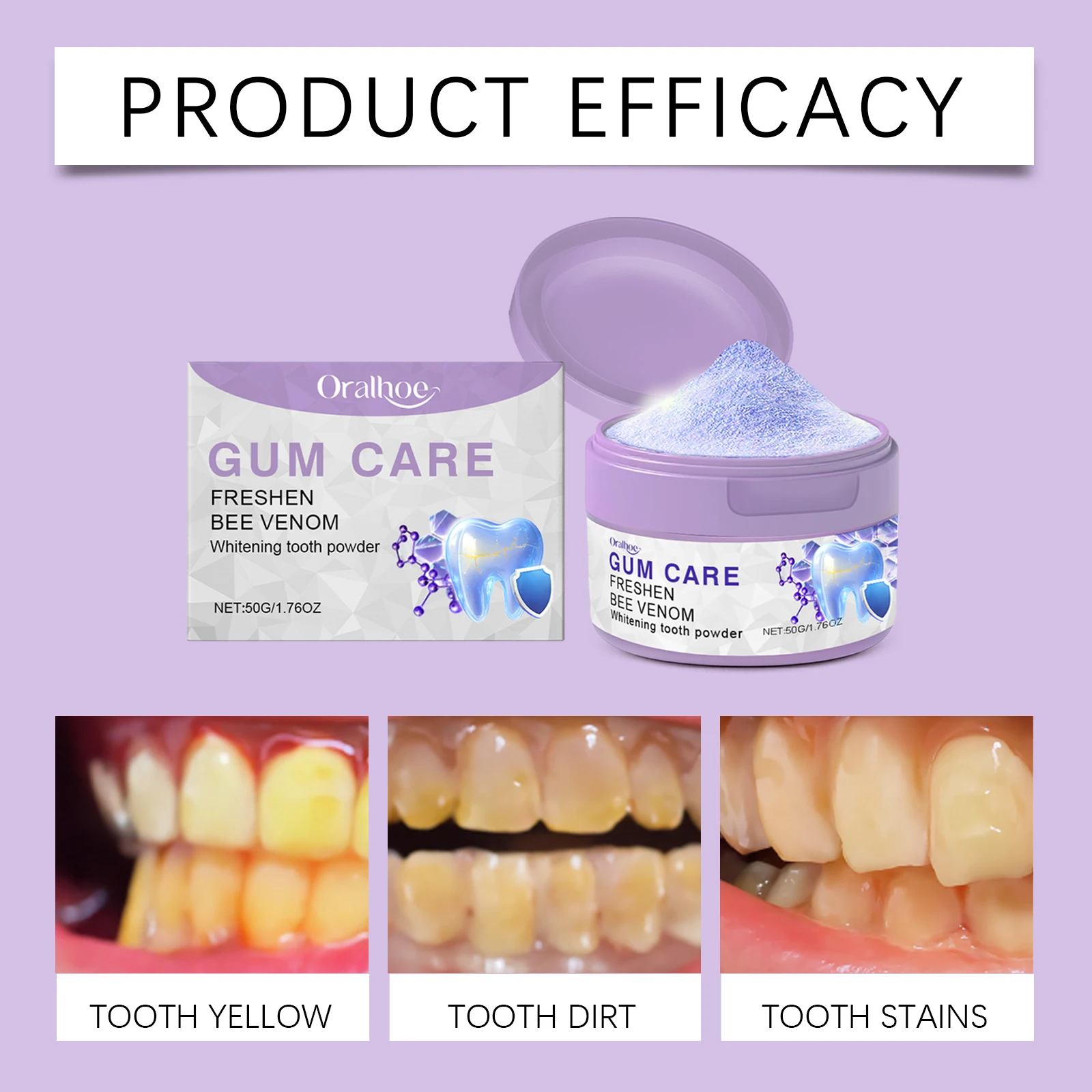 ORALHOE Zahnaufhellungspulver, Bienengift-Formel, schützt Zahnfleisch, Mund, Tiefenreinigung, Zahnlösung, Pigmentablagerung schnell, hellt die Zähne auf