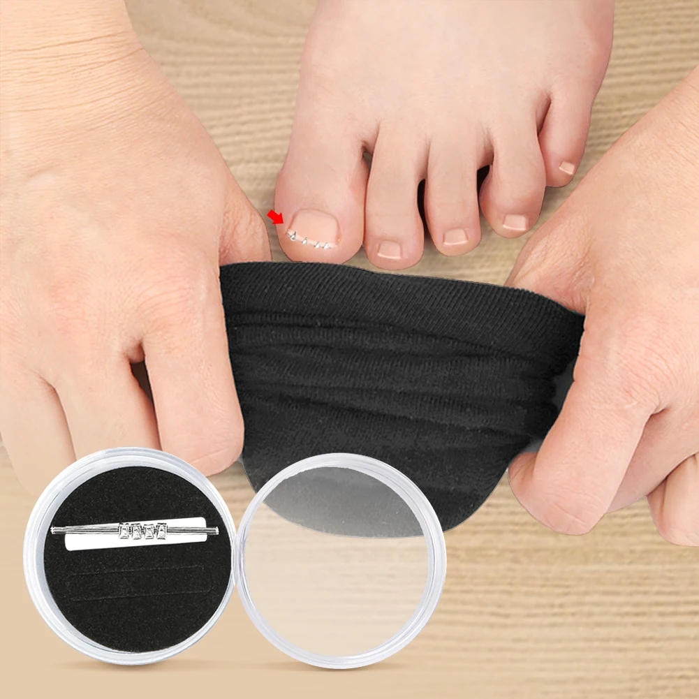 Ingrown Toenail Correction Foot Care Tool Ingrown Toenail Corrector Tool Embed Toe Nail Care Straightening Correction Clip