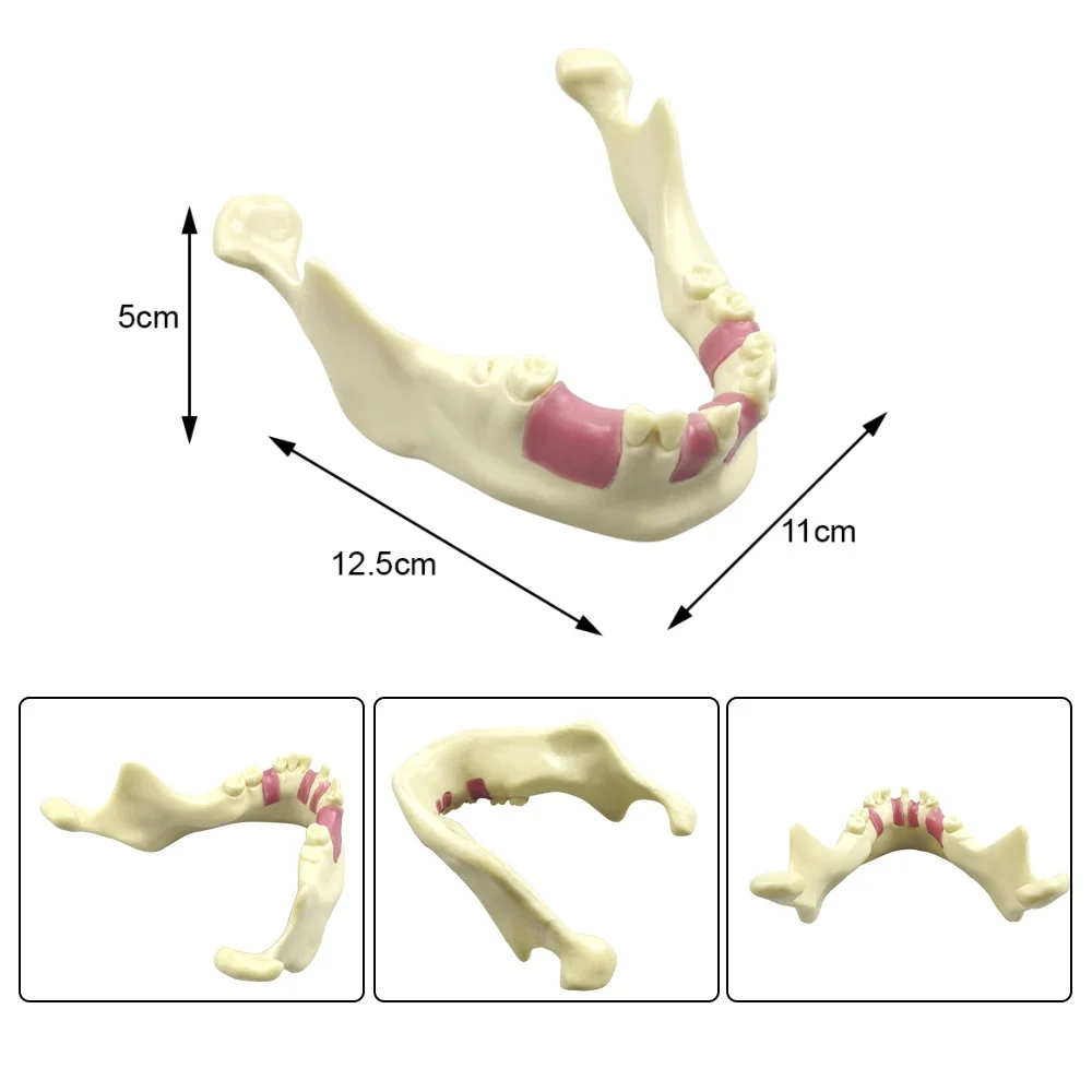 Dental Model Implant Practice Teeth Teaching Model Mandible Train Education Demonstration Tool Lower Jaw Bone Simulation Model