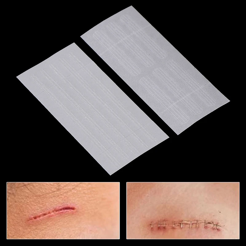 Wound Skin Closure Strips Surgical Sutures Postpartum Wound Repair Cosmetic Surgery Adhesive Medical Health Care