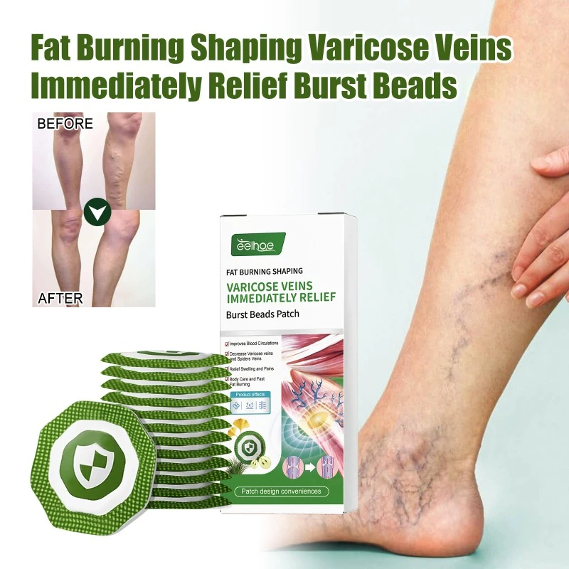 Slimming Vein Patch Relieve venous leg muscle swelling pain Vasculitis Phlebitis Spider Varicose leg Treat body shaping plaster