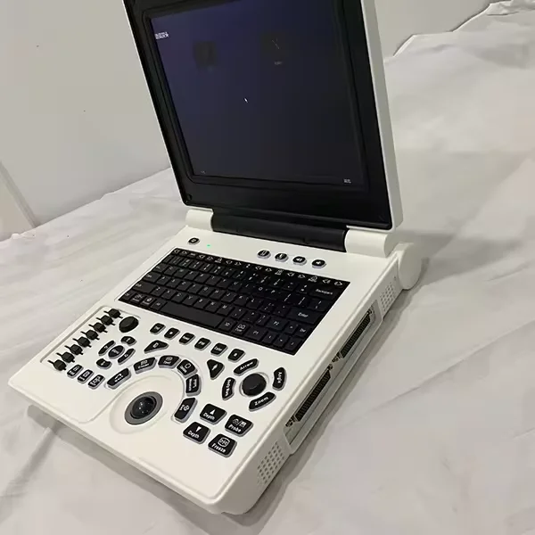 Harga Sistem Portabel Sonoscape E2pro Dijual Probe Human Being E2