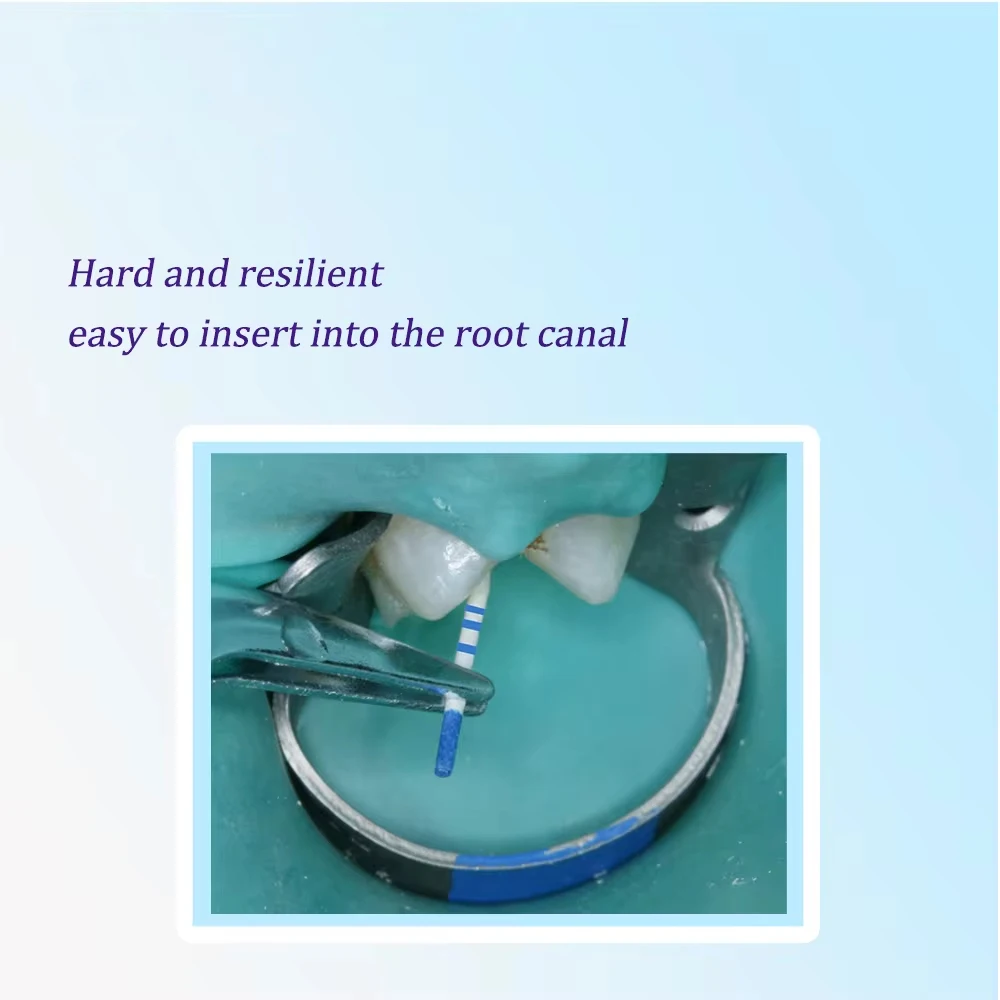 Dentistry Endodontics Paper Tips Cone Disposable Guttahanger Taper F1 F2 F3 Absorbent Fiber Poles Points Mark Dental Materials