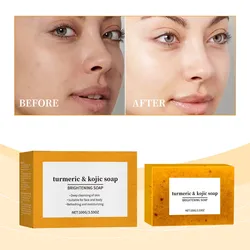 100g Lemon Skin Brightening Soap, Bar, Reduces Dark Spots, Hyperpigmentation And Other Types Of Skin Damage, Body Care Gift