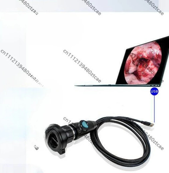 USB3.0 Endoscope Device Connect PC for Pet Surgery Ear Inspection Use