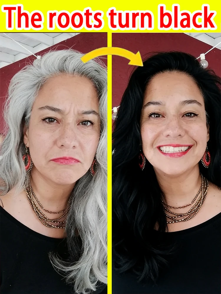 

Anti-gray hair serum, promotes black hair growth, and improves gray hair to black hair. Suitable for both men and women.