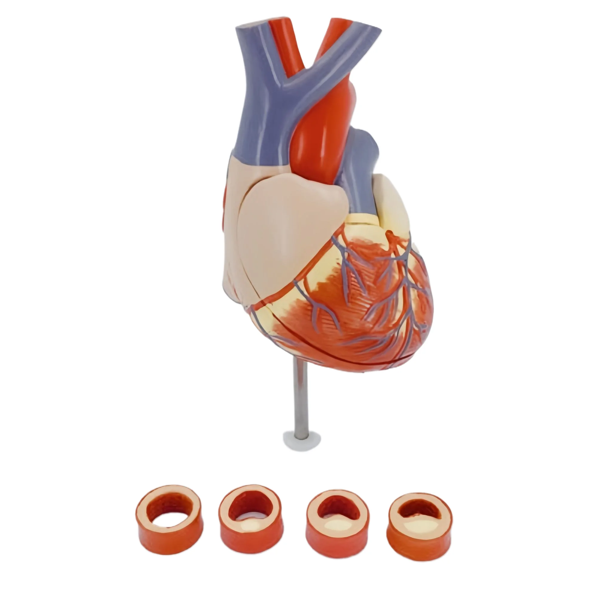 

High quality factory direct heart band thrombus model