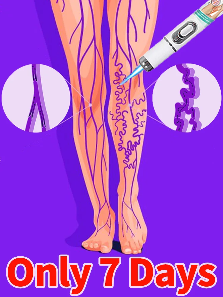 

Leg care tools eliminate spider leg varicose veins