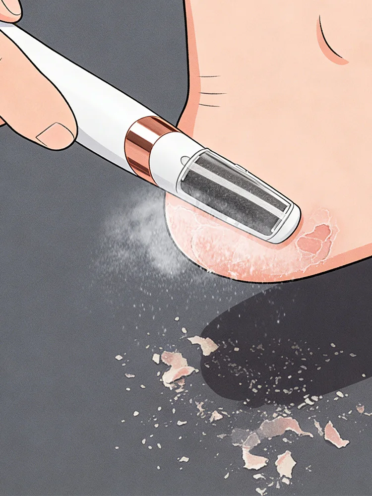 

USB Charging Electric Foot File Dead Skin Remover 2nd Gen Portable Pedicure Tool for Cracked Heel Callus