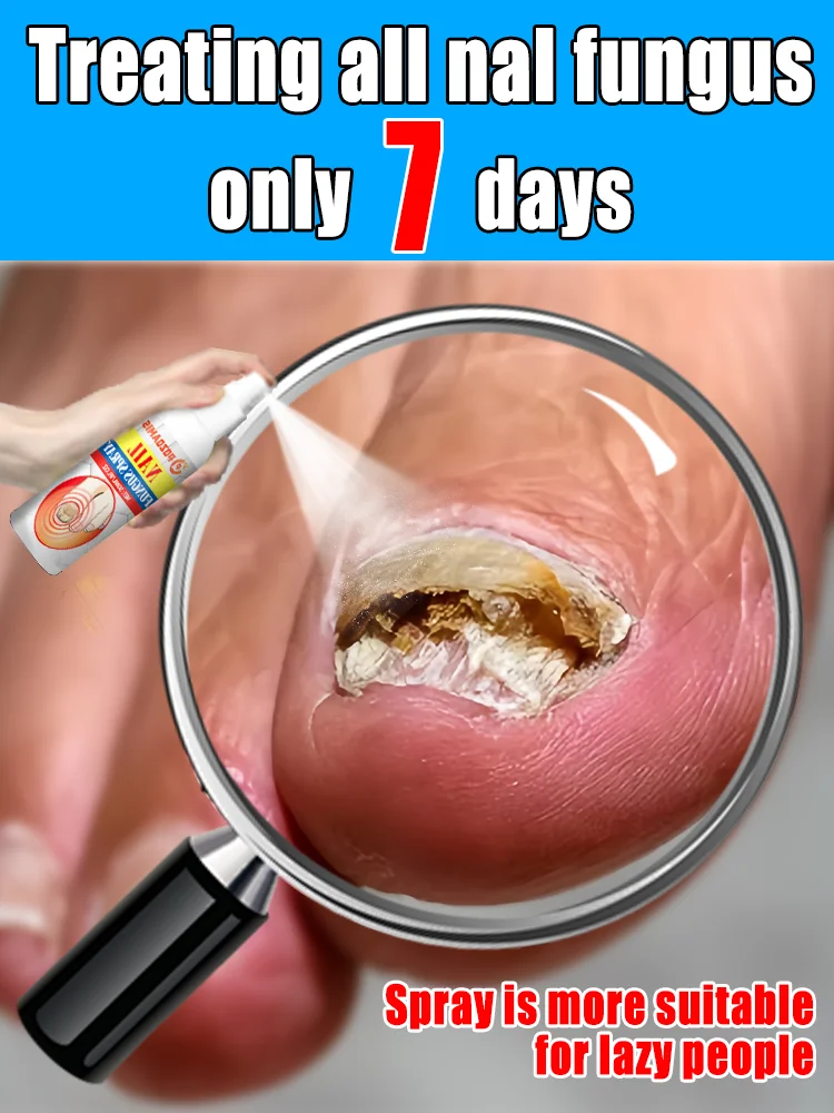 

The most powerful black technology in 2025,ᵉᶠᶠᵉᶜᵗⁱᵛᵉ ⁿᵃⁱˡ ᶠᵘⁿᵍᵘˢ ᵗʳᵉᵃᵗᵐᵉⁿᵗ⸴ ʳᵉˢᵗᵒʳᵉ ⁿᵃⁱˡ