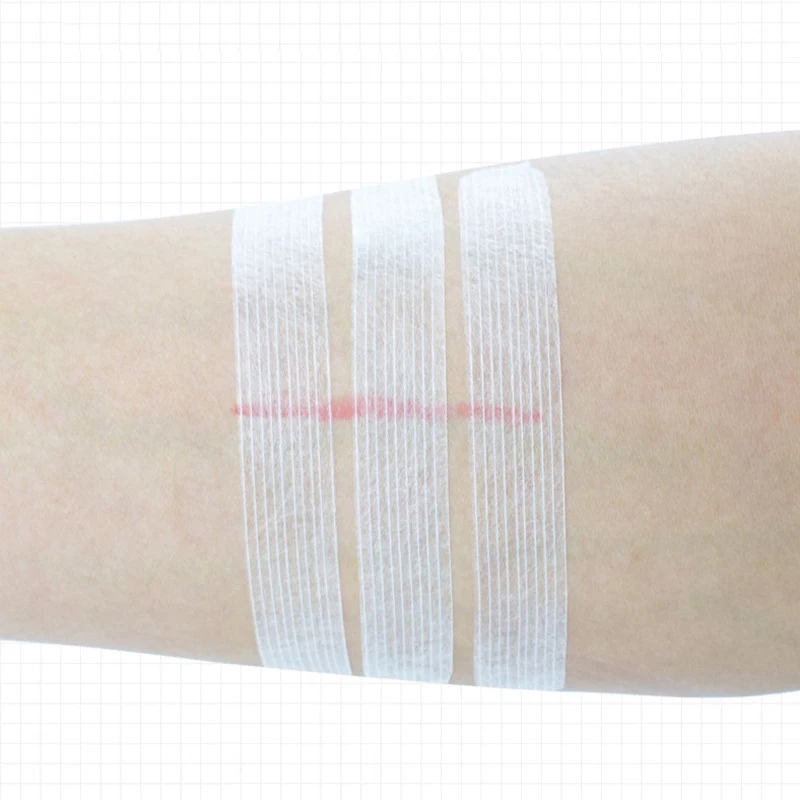 Wound Skin Closure Strips Postpartum Wound Repair Cosmetic Surgery Seam-Free Adhesive Medical Suture Free Surgical Tape