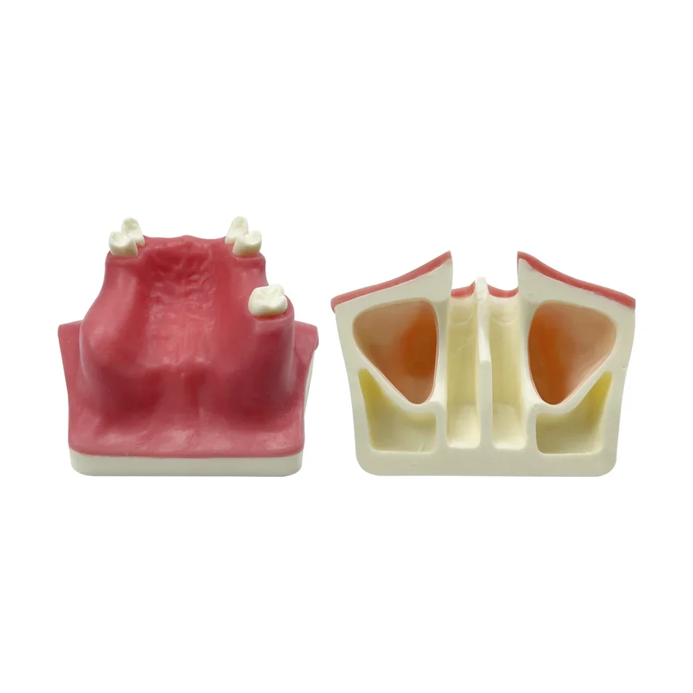 BODE Maxillary Sinus Implant Model Missing Teeth Soft Gum Model For Dental Students To Practice Training Teaching Tools