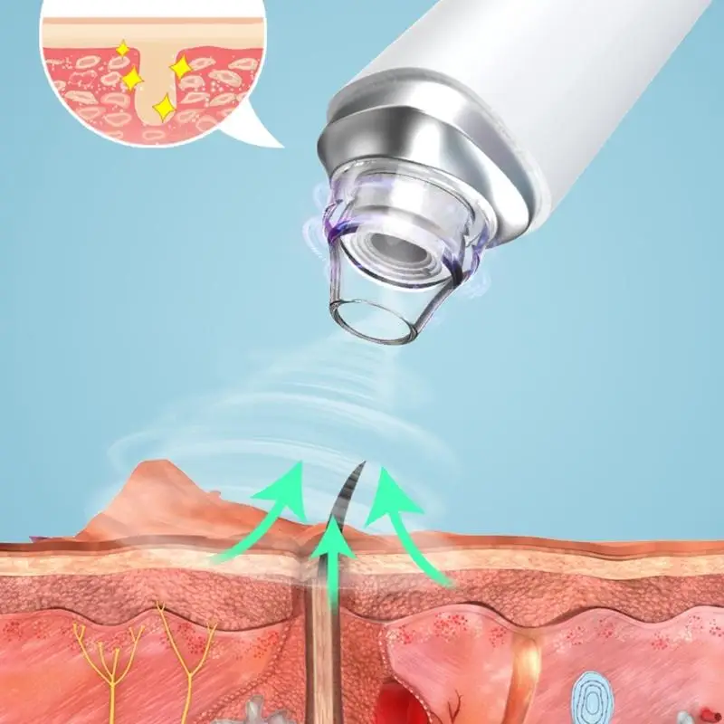 مزيل الرؤوس السوداء لتنظيف المسام متعدد السرعات من D0UE للوجه مع تحكم ذكي بالشفط ونصائح قابلة لإعادة الاستخدام #4