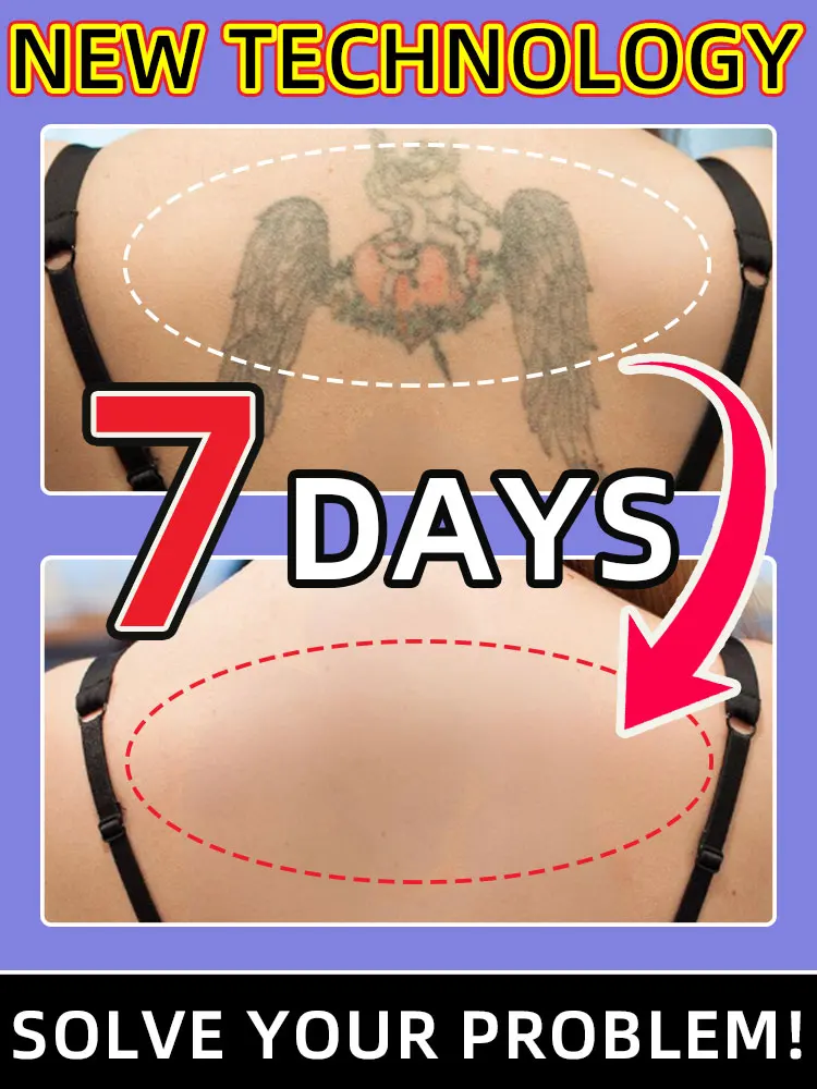 

Tattoo removal spray for pigmentation and permanent makeup marks
