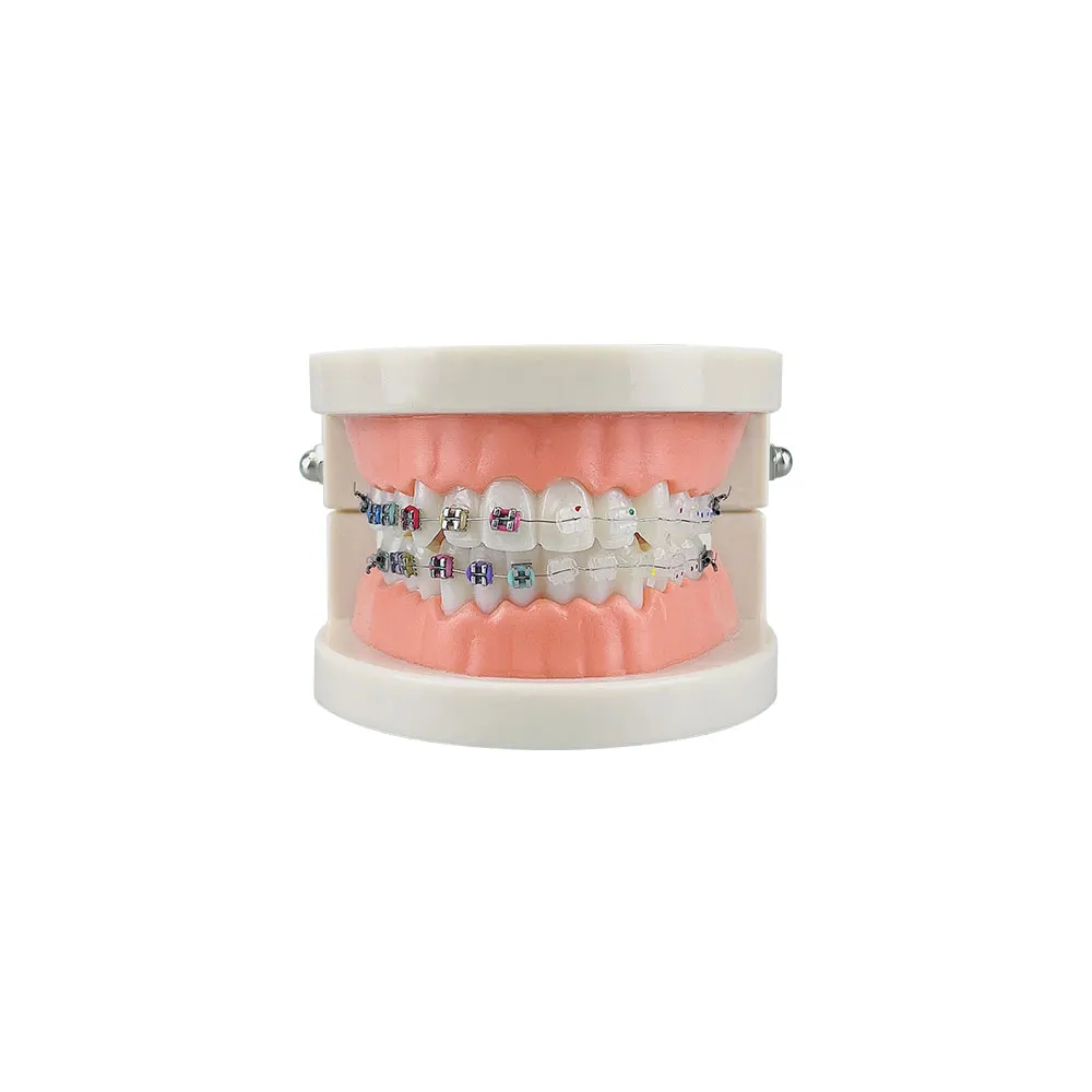 Modelo ortodôntico dental com suporte de cerâmica de metal arco fio tubo bucal ligadura laços tratamento dos dentes typodont ferramentas odontológicas