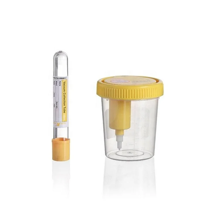 UC-V-10120 laboratory  lab supplies  90ml 120ml Plastic Cup Disposable Sterile vacuum urine tube vacuum Urine Container