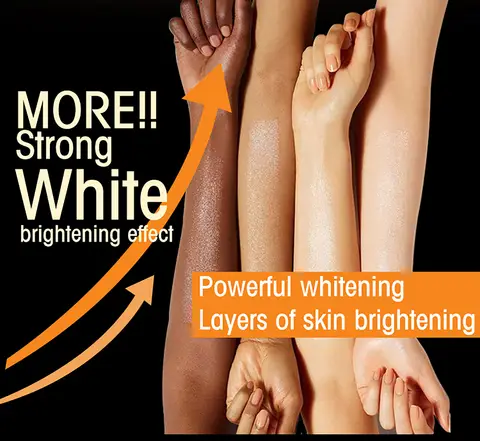 10 best sales hyperpigmentation - №2