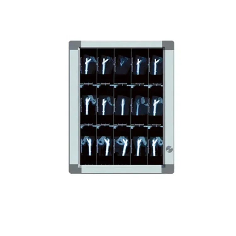 

OM-2PLA Medical Negatoscope Film Viewer Led X Ray Film Viewer Single Panel