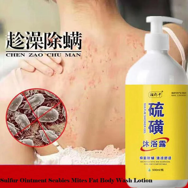 Effective Sulfur Ointment Scabies Mites Fat Bath Body Cream Sulphur Body Wash Lotion for Itching and Sterilization Whitening