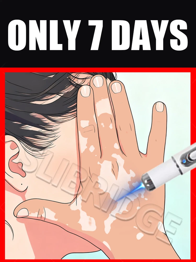 2025 Nueva actualización de bolígrafo de luz azul para resolver la herramienta de vitíligo