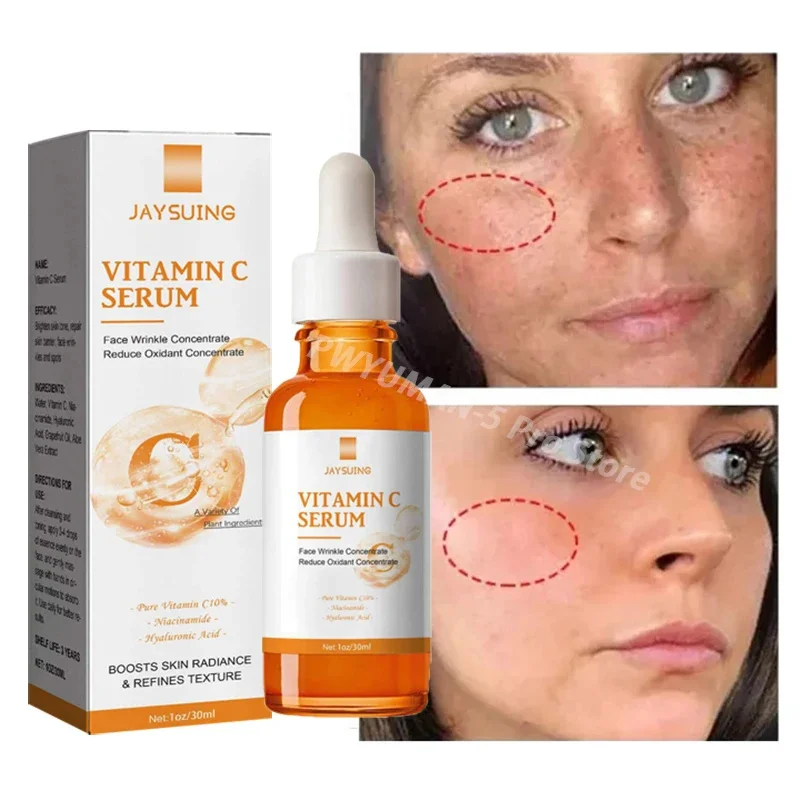 

Vitamin C Whitening Serum Face Remove Dark Spots Freckles Fade Melanin Retinol Anti-wrinkle Essence Brightening Korean Skin Care