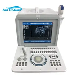 HBW-2 Medical ultra sound Equipment Full Digital Portable B/W Ultrasound Machine