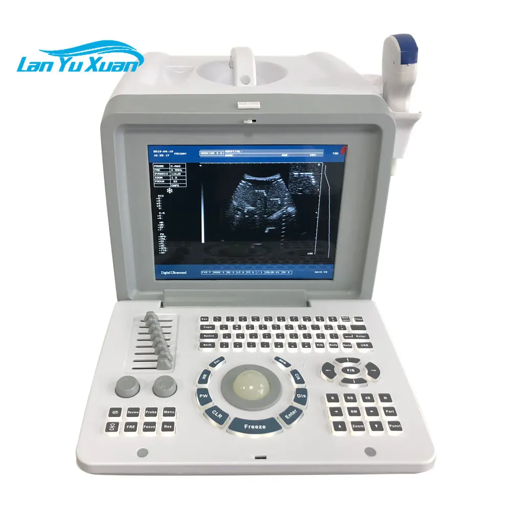 HBW-2 Medical ultra sound Equipment Full Digital Portable B/W Ultrasound Machine