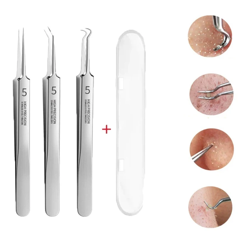 Stainless Steel Fine Tweezers Laboratory Tweezers Medical Beauty Tools Easy Blackhead Removal Acne Facial Cleanser Acne Clipper