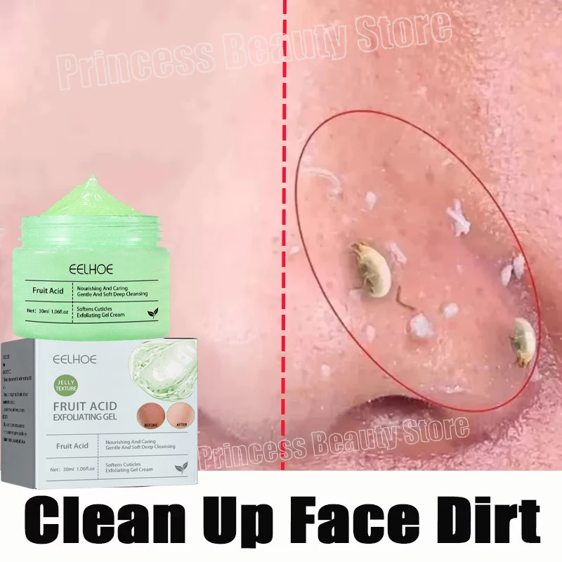 

Face Exfoliating Gel Skin Care Whitening Moisturizer Repair Facial Scrub Cleanser Acne Blackhead Treatment Remove Face Cream