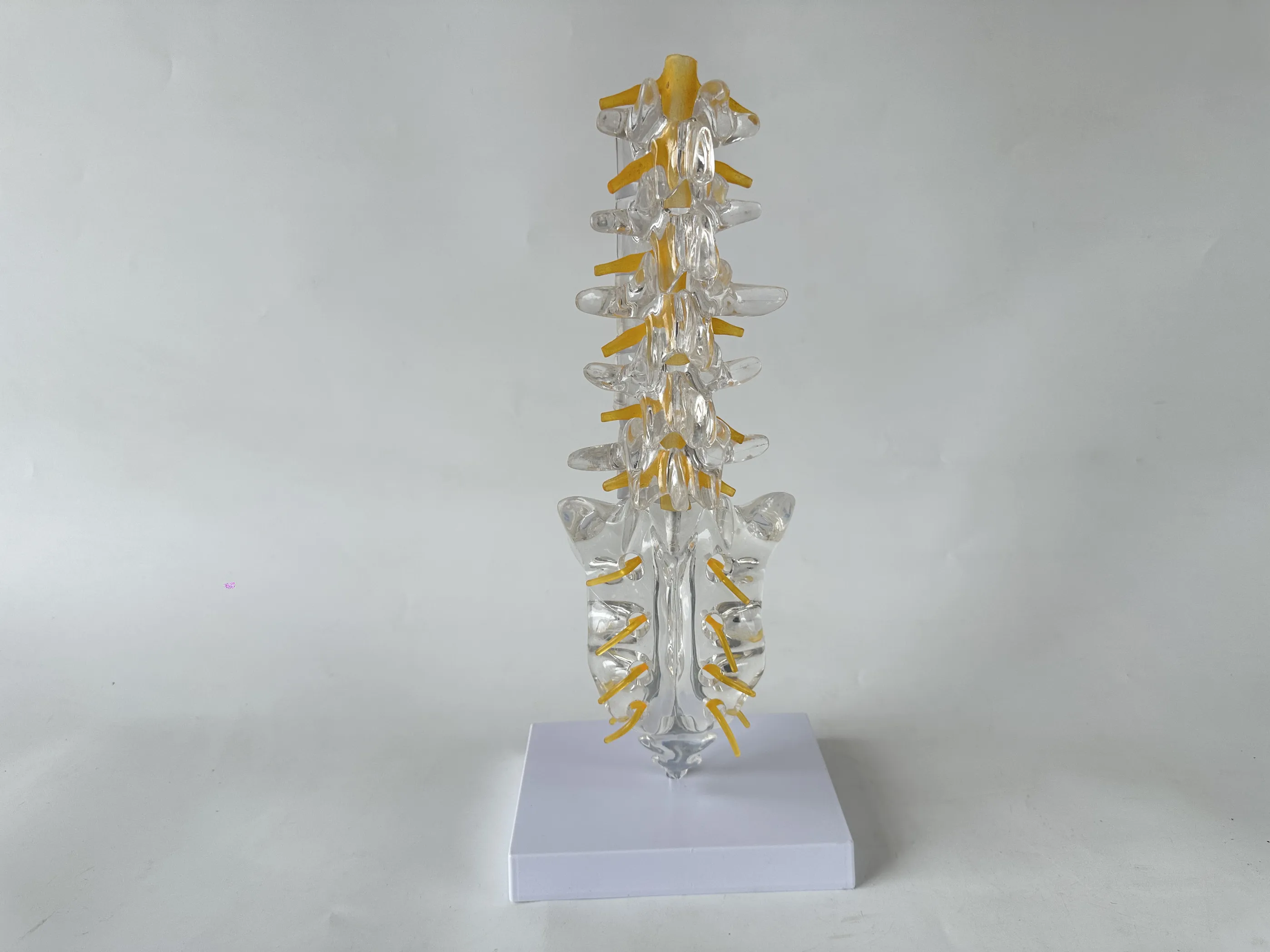 Transparent Lumbar Spine Model with Tailbone | 3D Teaching Sacrum & Spinal Nerve Model for Orthopedic Education