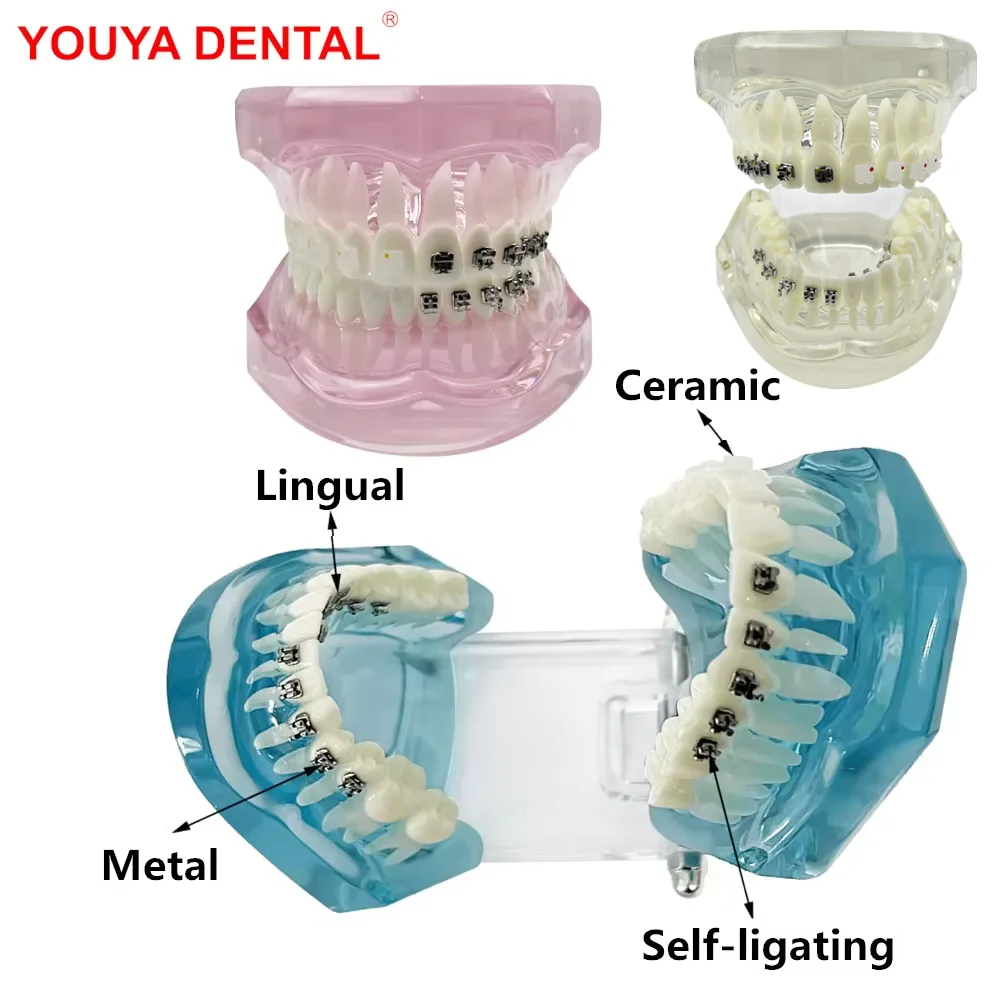 Dental Model Teeth Teaching Model With Self Ligating/ Metal/ Lingual/ Ceramic Orthodontic Brackets Teeth Model For Studying Demo