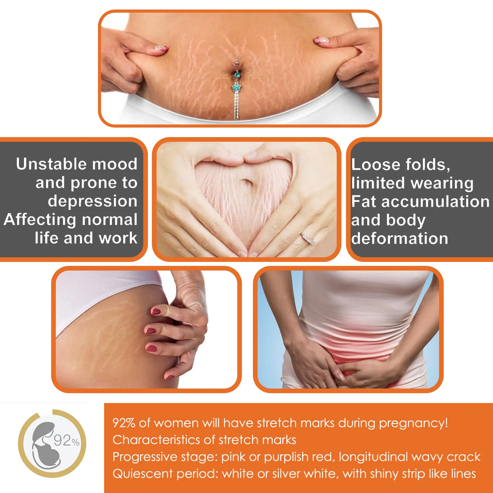 100g Stretch Marks Permanent Removal Cream Maternity Pregnant Women Pregnancy Anti-Winkle Smooth Repair Firming Skin Body Care view 3