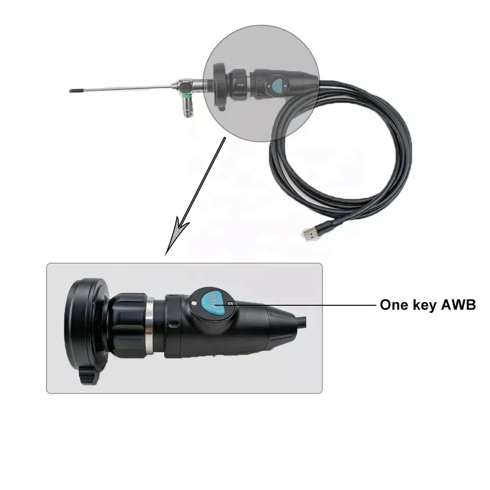 USB3.0 1080P Full HD Medical Portable Endoscopic High Resolution CMOS endoscop camer for ENT Laparoscope Gynecology