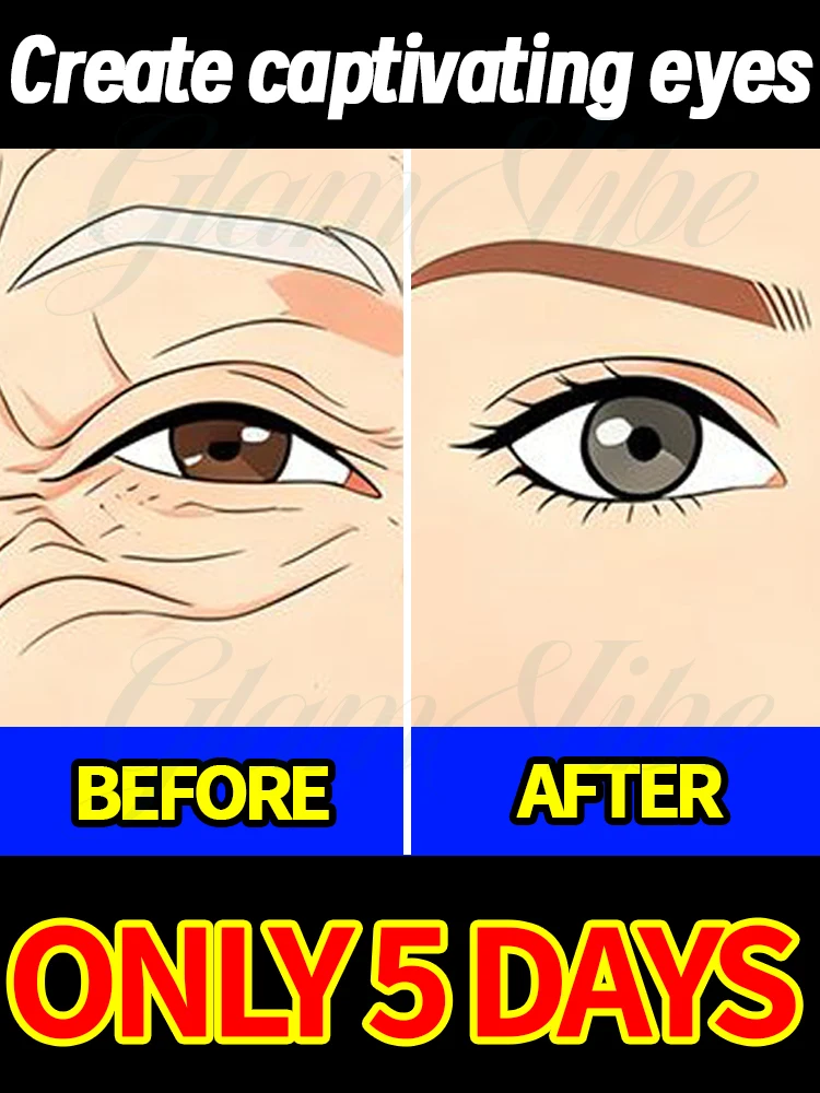 

Eye area repair, revealing a more youthful appearance