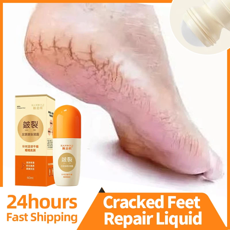 Anti Crack Foot Cream Drying Cracked Peeling Feet Repair Foot Mask Hand Dead Skin Removal Heel Chapped Dew Moisturizing Care