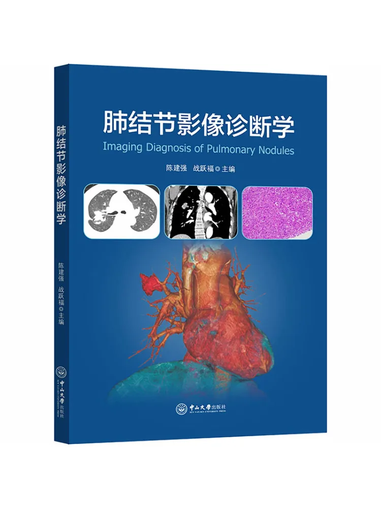 Book-Winshare Imaging Diagnosis Of Pulmonary Nodules