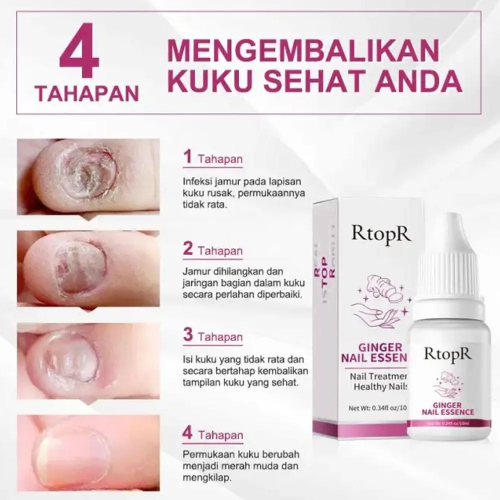 علاج أظافر الزنجبيل زيت طبيعي مغذي تعزيز إصلاح تغير لون كسر أصابع سميكة إصلاح حامي الأظافر التالفة