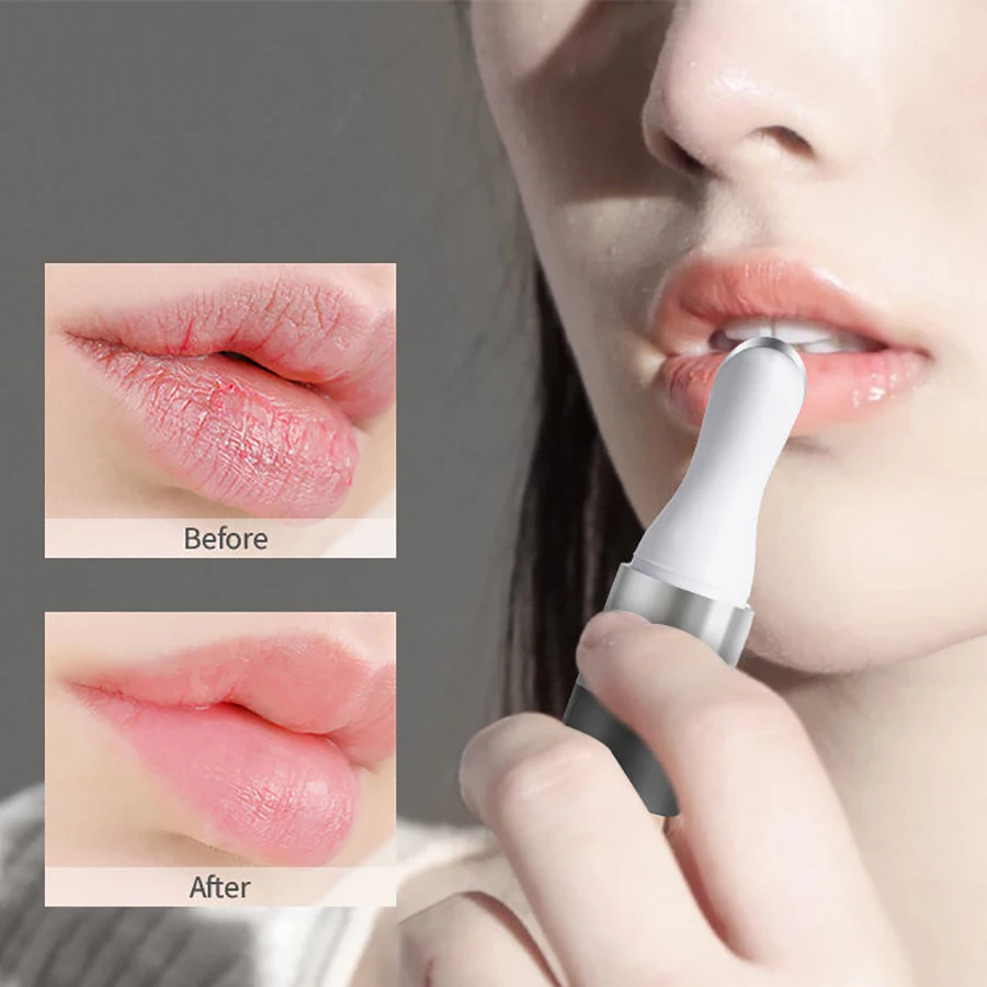 Lip massage Device Beauty Quick Enhancer Treatment Bigger Mouth Lip Care