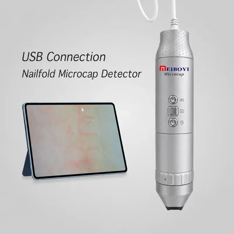 Hot Sale Meiboyi Microcap 200X Handheld Nailfold Capillaroscopy Microcirculation Microscope Digital Capillary Detector for