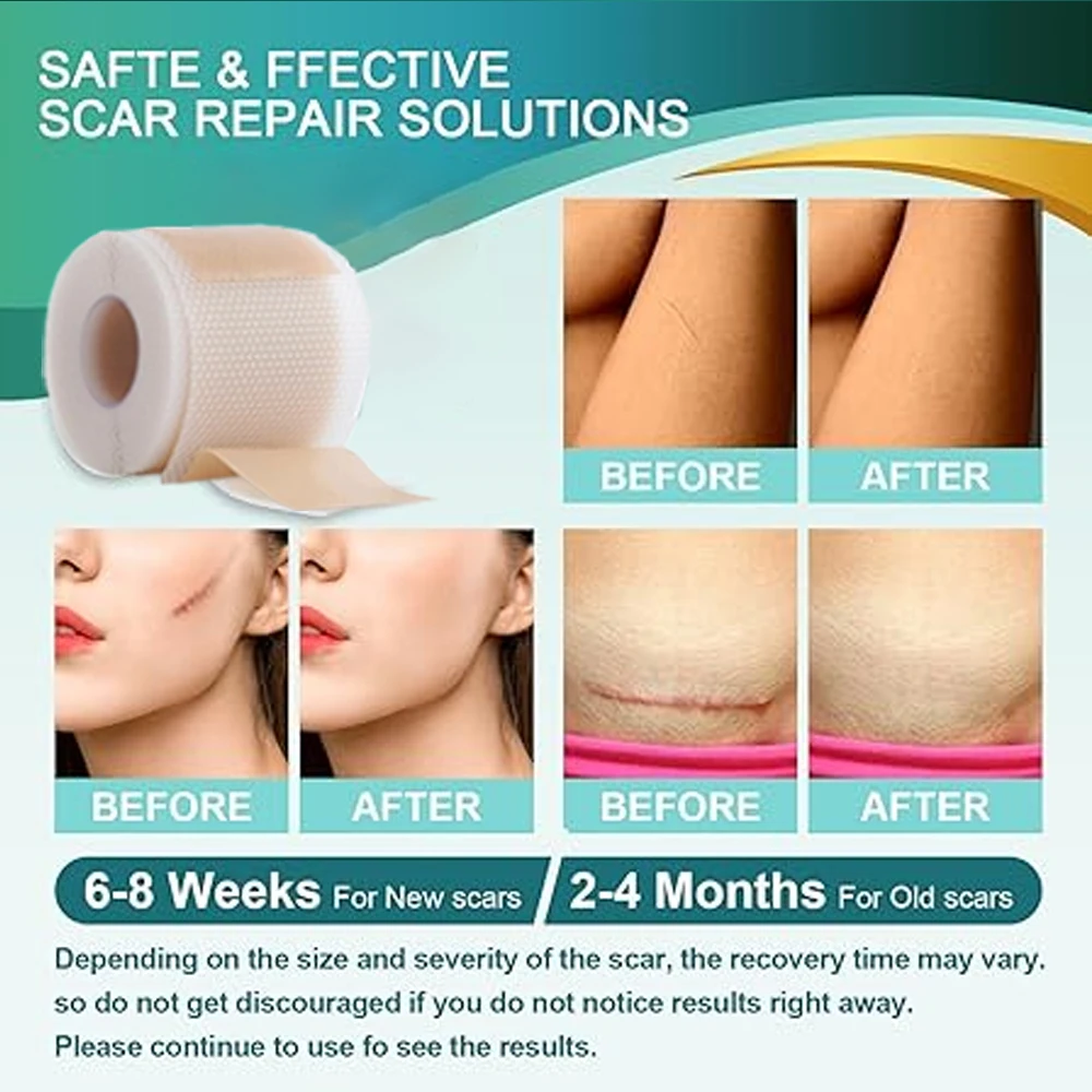 صفائح الندبات السيليكونية، تتلاشى الندبات القديمة والجديدة من الجراحة، القسم C، الإصابة، إزالة الندبات القابلة لإعادة الاستخدام والفعالة
