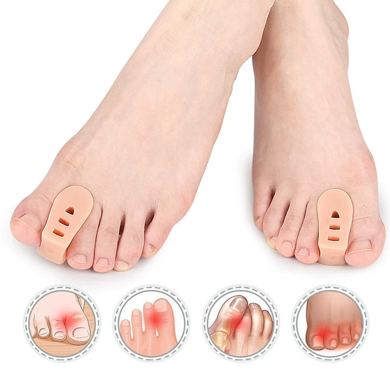 1/5/10Pair Gel Toe Orthosis Clip Pads Big Foot Bone Care Tools Splitter Thumb Hallux Valgus Bunion Corrector Overlap Separators