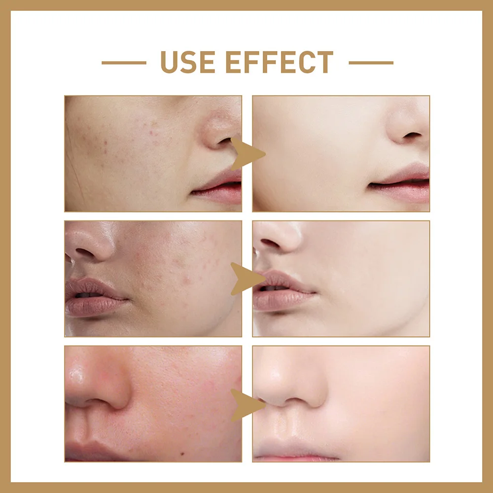 Rice Water Face Toner Deep Hydration Moisturizer Barrier Repair Smooth Soft Skin Care Lotion Daily Extra Rich Essence