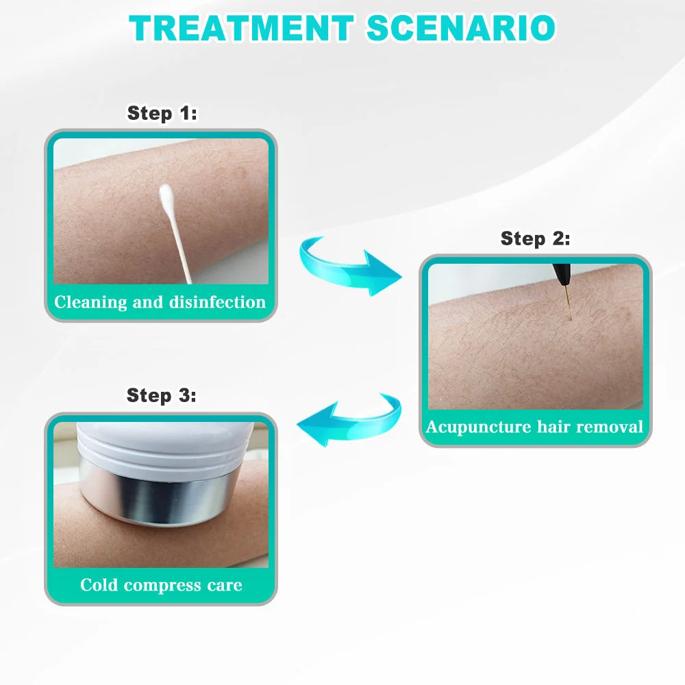 Thumbnail 3 - #25 Highest Rated Epilators to Buy in 2026