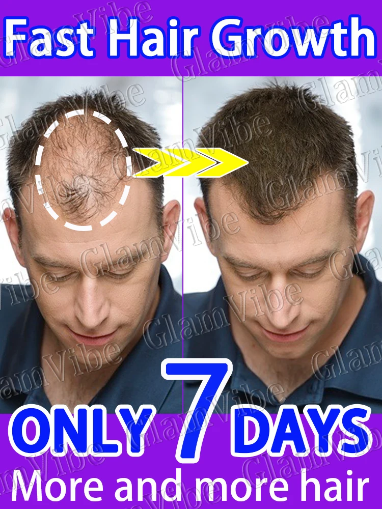 

Hᴀᴠɪɴɢ ᴛʜᴇ sᴀᴍᴇ hairstyle as Elvis Presley marks the pinnacle of one's l̶i̶f̶e̶.̶